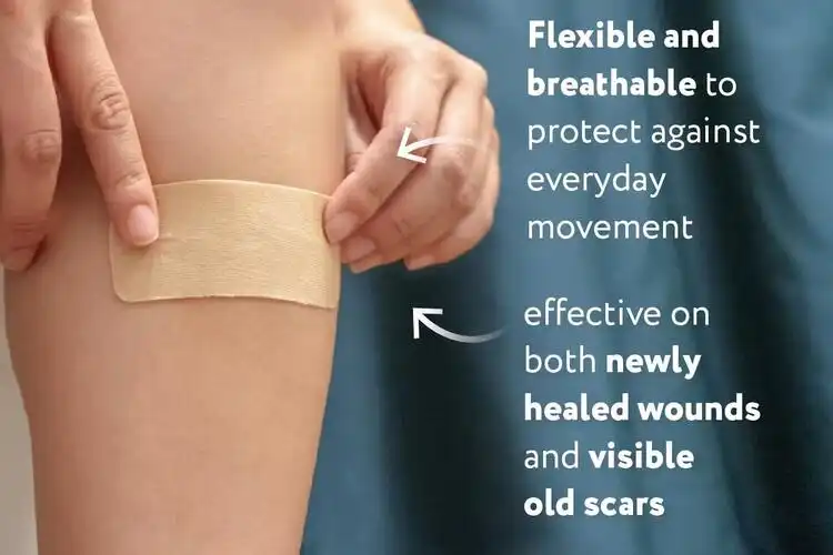 Silicone Scar Tape: Thickness, Durability and Reusability Features